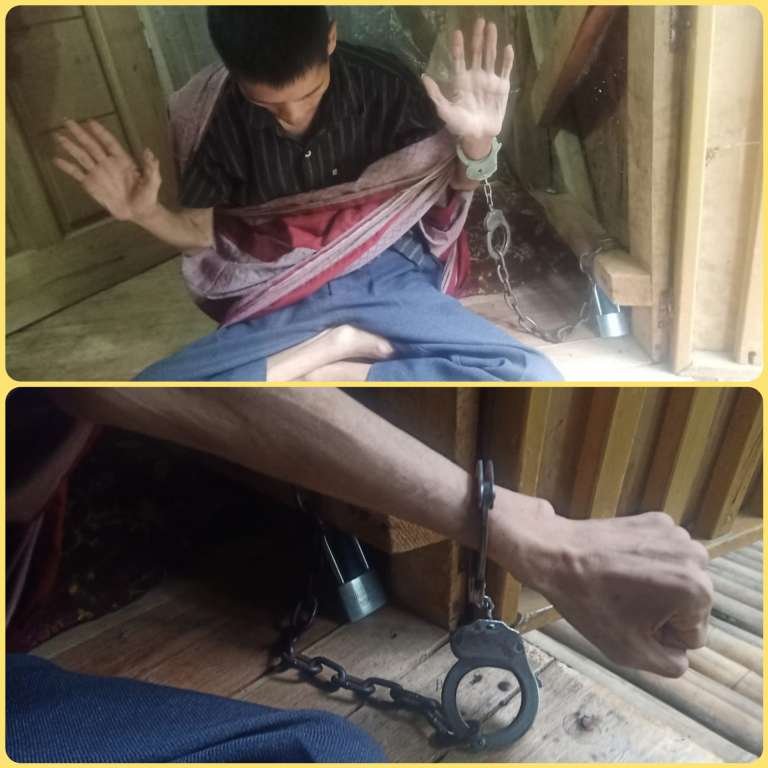 Duh, Tak Jauh Dari Pendopo Ada ODGJ Dipasung Dengan Borgol